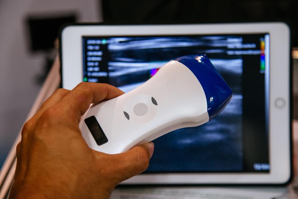 Future of Ultrasound Medical Devices explained by PostDICOM